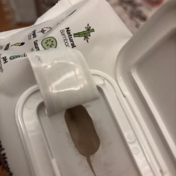 İçinde Küf Olan Yenidoğan Mendili Güvenimizi Sarsıyor