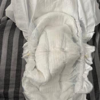 Molfix Ultra Bezlerde Sızdırma, Koku Ve Pamuk Eksikliği Şikayeti