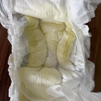 Molfix Ultra Bezlerde Sızdırma, Koku Ve Pamuk Eksikliği Şikayeti