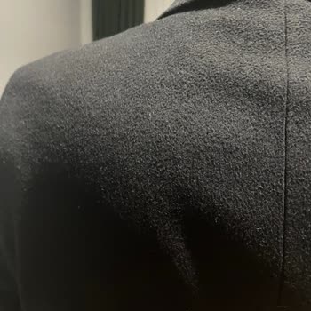 Erkek Kaşe Kabanın Hızlı Tüylenmesi Ve İade Talebi