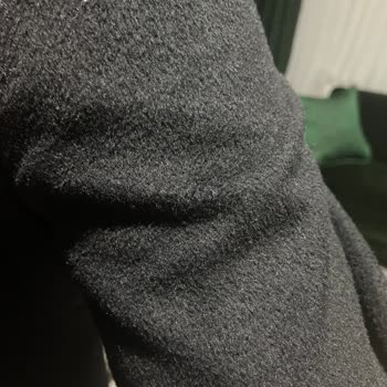 Erkek Kaşe Kabanın Hızlı Tüylenmesi Ve İade Talebi