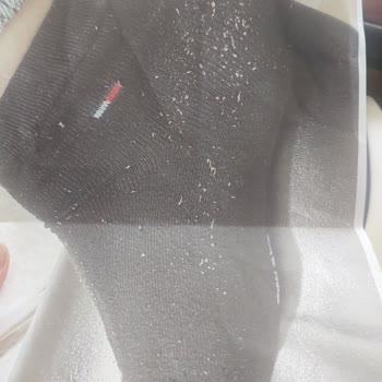 Ayakkabının 10 Dakikada Parçalanması Ve Mağazanın Fotoğraf Üzerinden Hatasız Ret Kararı