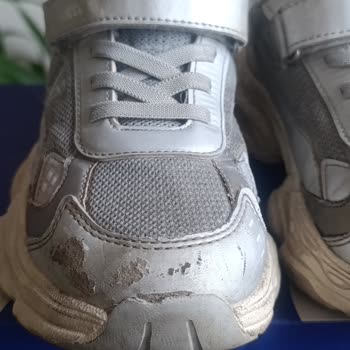 Vicco Çocuk Ayakkabısında Deri Dökülmesi Ve Şirketin Reddine Karşı İade Talebi