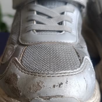 Vicco Çocuk Ayakkabısında Deri Dökülmesi Ve Şirketin Reddine Karşı İade Talebi