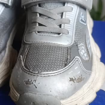 Vicco Çocuk Ayakkabısında Deri Dökülmesi Ve Şirketin Reddine Karşı İade Talebi