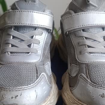 Vicco Çocuk Ayakkabısında Deri Dökülmesi Ve Şirketin Reddine Karşı İade Talebi