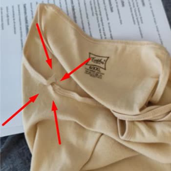 Tutku Atlette Dikiş Açılması Ve İletişim Eksikliği