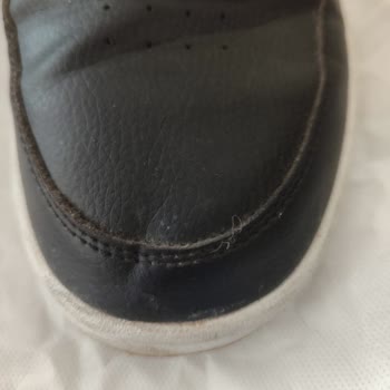 Deichmann Ayakkabı Deformasyonu Nedeniyle İade Talebi