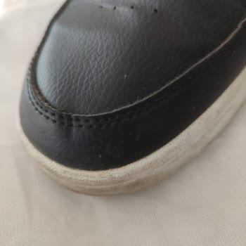 Deichmann Ayakkabı Deformasyonu Nedeniyle İade Talebi