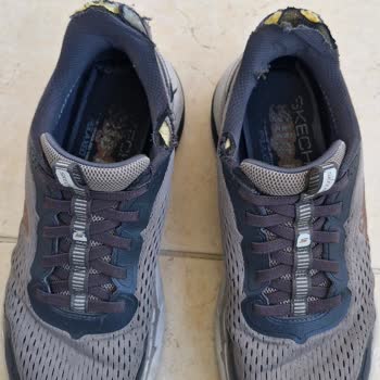 Patlayan Topuklu Skechers Ayakkabının İade Talebi Reddedildi