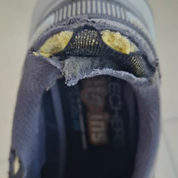 Patlayan Topuklu Skechers Ayakkabının İade Talebi Reddedildi