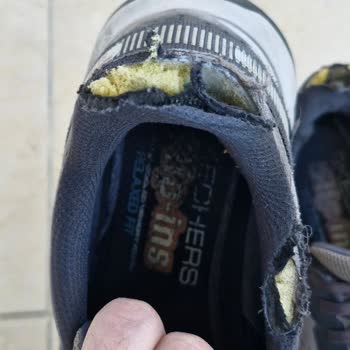 Patlayan Topuklu Skechers Ayakkabının İade Talebi Reddedildi