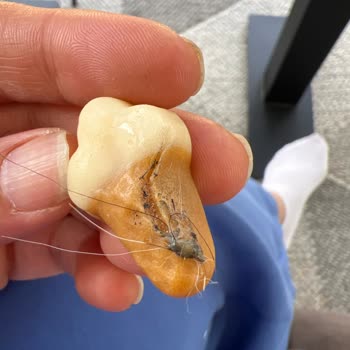 Bebeto Ice Cream Jelibon Ürününün Kalitesizliği Ve Sağlık Endişesi