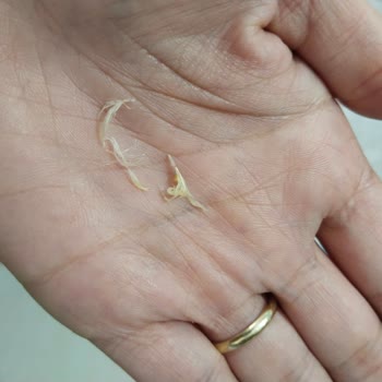 Lezita Çıtır Kova'da Tüy Bulunması Ve Hijyen Sorunu