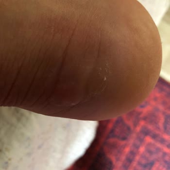 Puma RS-X Efekt Ayakkabısında Hızlı Yırtılma Ve Dikiş Atması Nedeniyle Tam İade Talebi