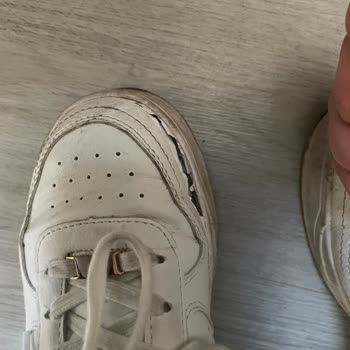 Bershka Spor Ayakkabısının Kısa Sürede Açılması Ve Deri Soyulması