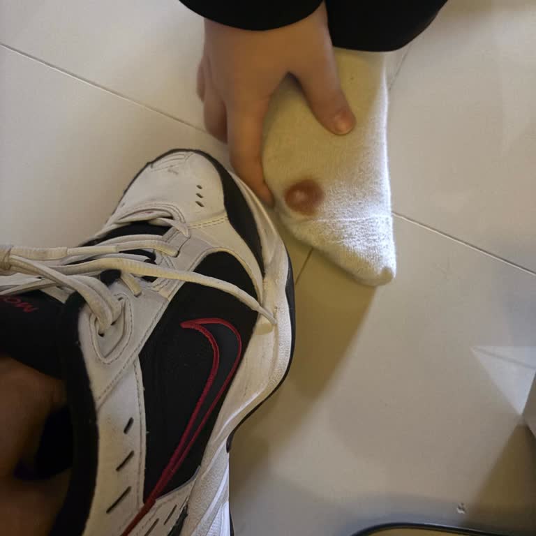 Nike Ayakkabısındaki Keskin Cisim Yaraladı, Boyner Cevapsız Kaldı