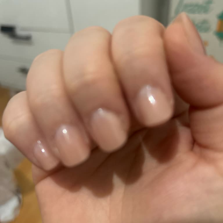 Kalitesiz Protez Tırnak İşlemi Ve İade Talebi