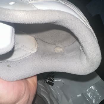 Adidas Ayakkabıda Tekrarlanan Üretim Hatası Ve Kullanıcı Hatası İddiaları