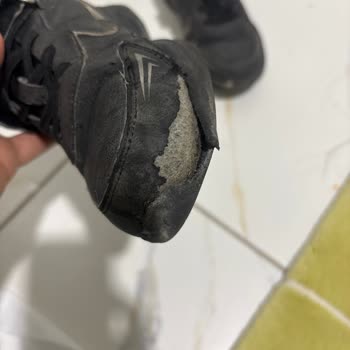 Üç Ayda Deri Soyulması: Üretim Hatası İncelemesi Ve Değişim Talebi