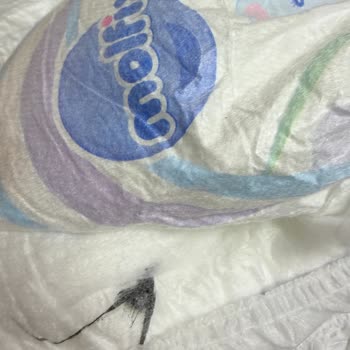 Molfix Bebek Bezinde Siyah İplik Benzeri Yabancı Madde Tespiti Ve Kontrol Talebi