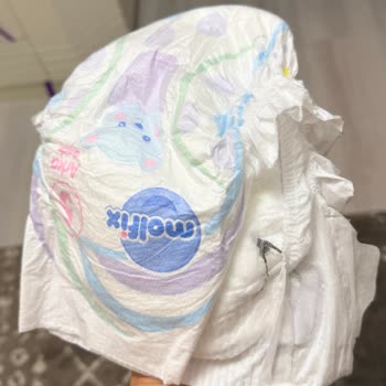 Molfix Bebek Bezinde Siyah İplik Benzeri Yabancı Madde Tespiti Ve Kontrol Talebi