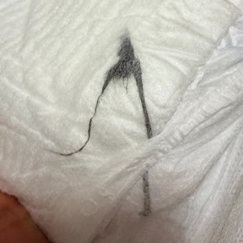 Molfix Bebek Bezinde Siyah İplik Benzeri Yabancı Madde Tespiti Ve Kontrol Talebi