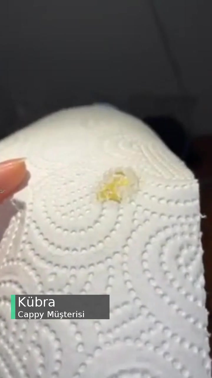 Cappy Pulpy Portakallı İçecekte Yabancı Madde Var! videonun kapak resmi