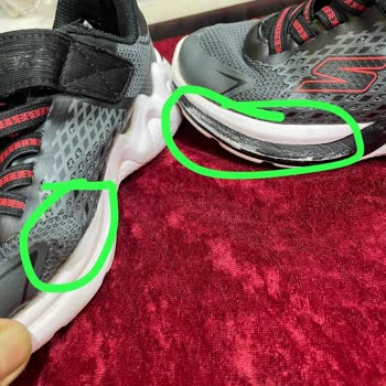 Skechers Ayakkabısının Hızlı Yırtılması Ve Mağaza Reddi