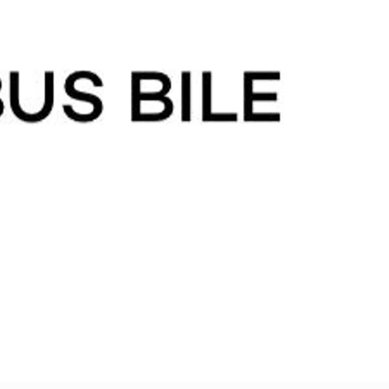 Ödeme Çekildi, Bilet Ve Bilgilendirme Alınamadı
