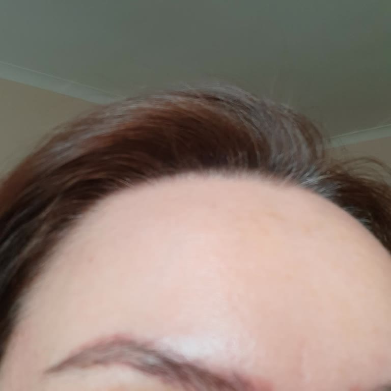 Kalitesiz Microblading Sonucu Ve Ücret İadesi Talebi