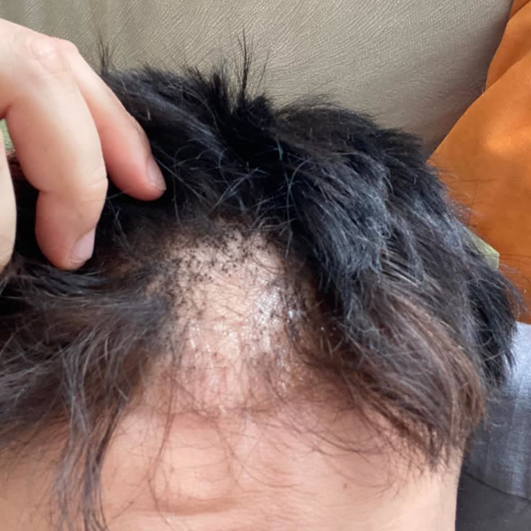 Oscar Hair Design Temin Ettiğim Ürünle İlgili Ciddi Bir Problem Yaşadım