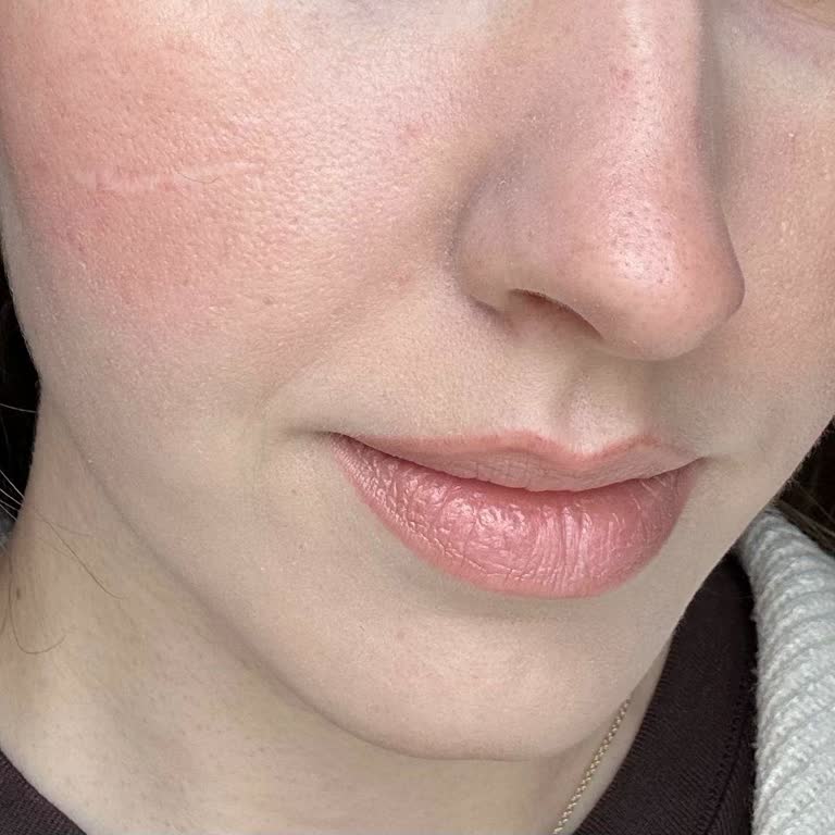 Yenilenmiş Missha Kremi Ciltte Kuruluk Ve Pul Dökülmesine Neden Oldu