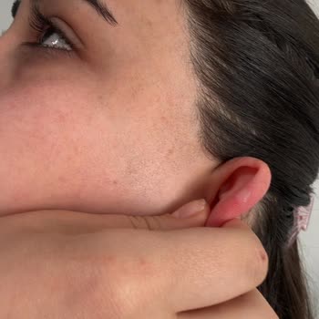 Nikah Günü Saç Ve Makyajda Yaşanan Sorunlar Ve Ücret İadesi Talebi