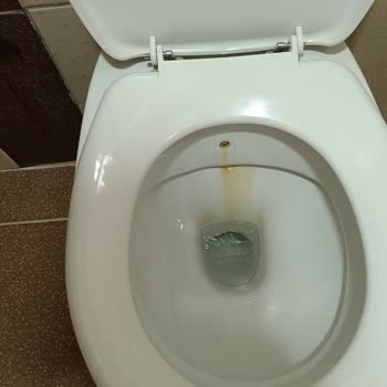 Bezmiâlem Hastanesi Vâkıf Hastanesinde Tıbbi Umursamazlık Ve Aşırı Ücretlendirme