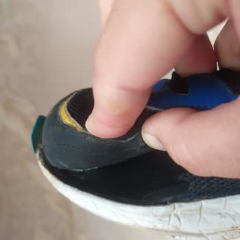 Kısa Sürede Deforme Olan Ayakkabı İçin Değişim Ve Detaylı İnceleme Talebi