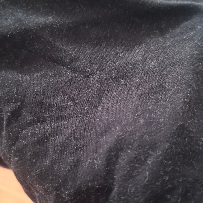 Windsor Çamaşır Makinesi Toz Bırakıyor: Alerjik Kaşıntı Ve Sağlık Sorunları