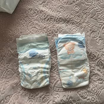 Molfix Premium Smart Fit 6 Numaralı Bebek Bezinde Sızdırma Ve Pişik Sorunu