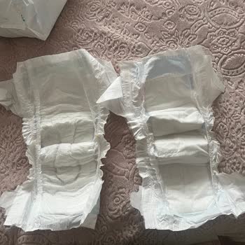 Molfix Premium Smart Fit 6 Numaralı Bebek Bezinde Sızdırma Ve Pişik Sorunu