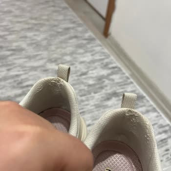 Skechers Ayakkabısında İç Deformasyon Ve Kalite Şikayeti