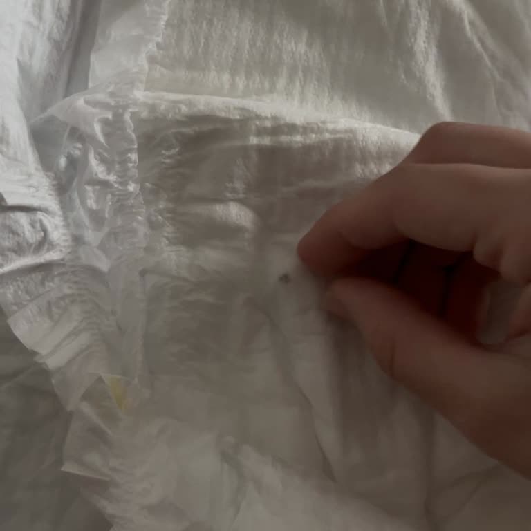 Molfix Bebek Bezi İçinde Bulunan Sert Siyah Cisim Ve Geri Dönüşsüz İhmal