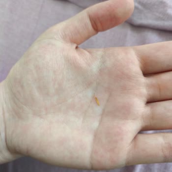 Ülker McVitie’s Saklıköy Çikolatalı Tam Tahıllı Bisküvi İçinde Sert Yabancı Madde Dişe Saplandı