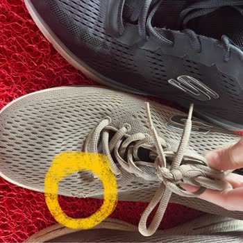 Skechers Ayakkabılarda Az Kullanımda Ciddi Deformasyon Ve Mağaza Reddi