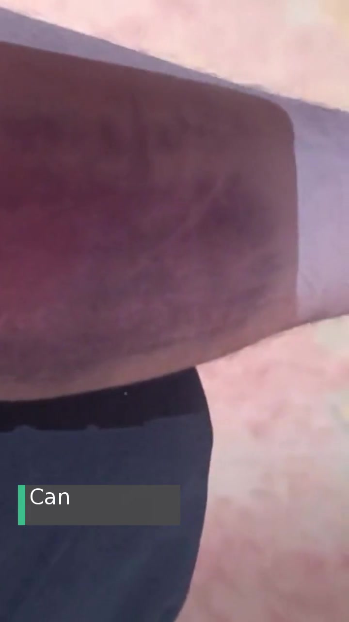 Maltepe Devlet Hastanesi Kan Almada Yaşanan Sıkıntı! videonun kapak resmi