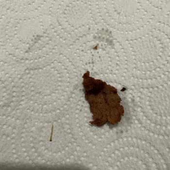 BİM Hazır Et Dönerinde Sert Yabancı Cisim Bulundu