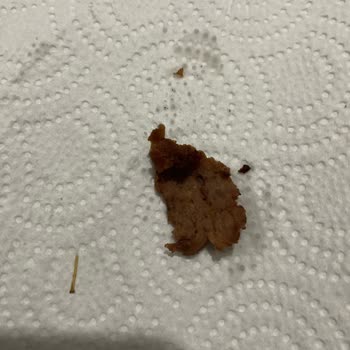 BİM Hazır Et Dönerinde Sert Yabancı Cisim Bulundu