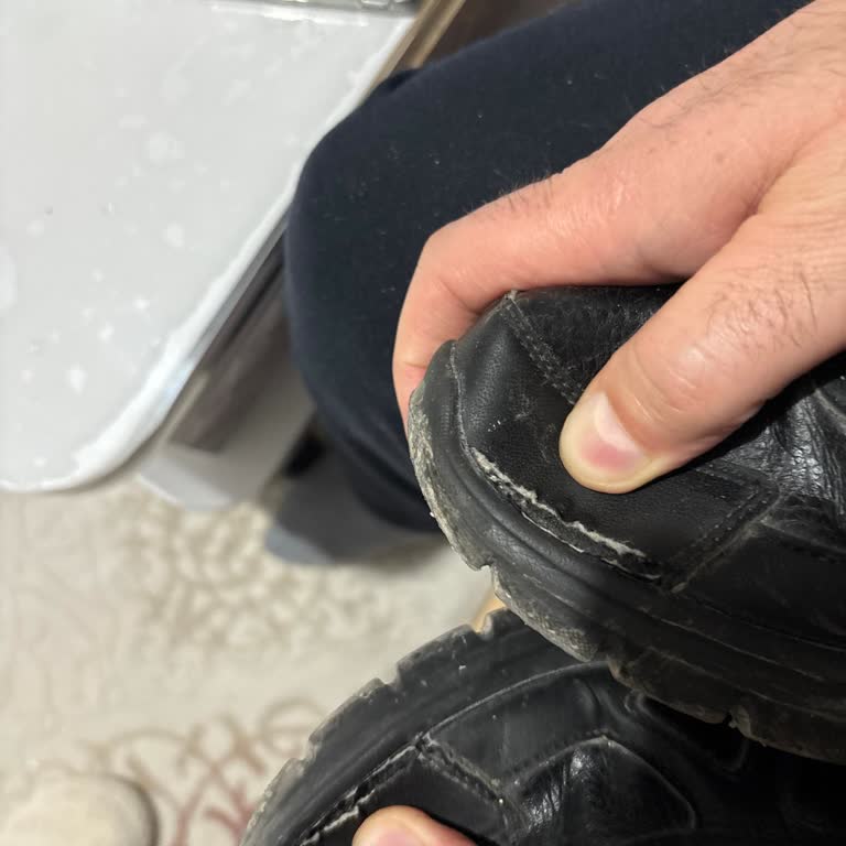 Skechers Ayakkabılarda Yan Açılma Ve Kalite Sorunu