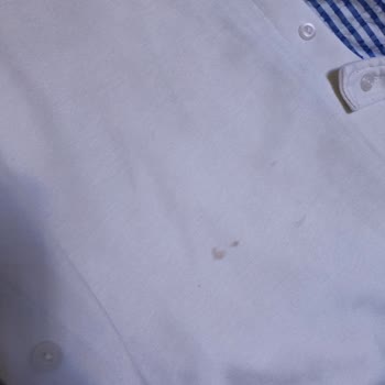 Bosch Çamaşır Makinesi Lekeli Yıkama, Servis Çözüm Sunmuyor: Değişim Talebi