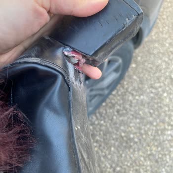 Botta Topuk Kırılması Ve Mağazanın Kullanıcı Hatası İddiası