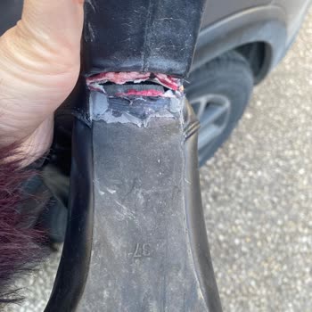 Botta Topuk Kırılması Ve Mağazanın Kullanıcı Hatası İddiası